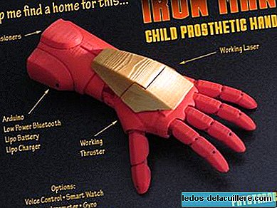 Futuristic prostheses for children, inspired by Iron Man