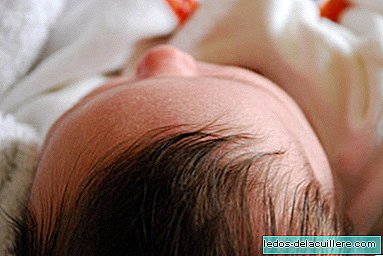 زيادة القلق عند الأطفال المولودين برأس صغير بسبب فيروس زيكا