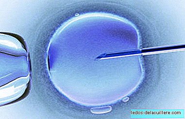 Do assisted reproduction techniques cause more birth defects?
