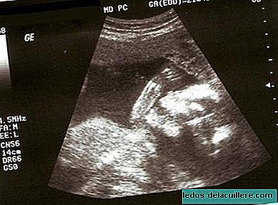 Pregnancy tests: detection of chromosomal abnormalities