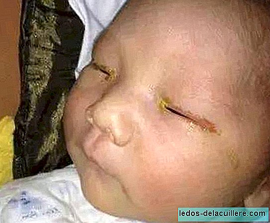 Can a three-month-old baby go blind for taking a flash photo?