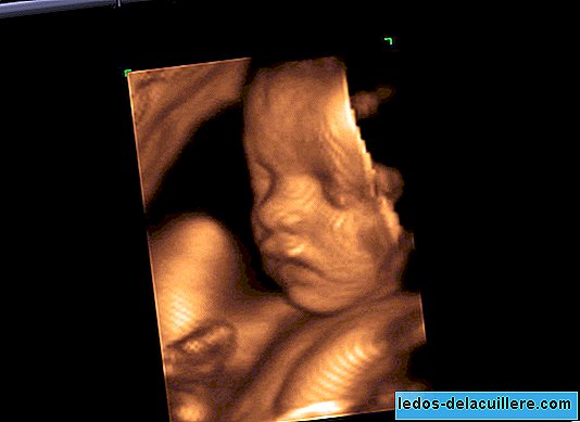 Minggu ke-33 kehamilan: bayi anda sudah bermimpi