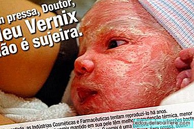 "Without hurry, doctor, my vernix is ​​not dirt"