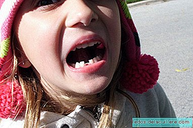 Erschreckendes Foto des Schädels eines Kindes, dessen erste endgültige Zähne herauskamen