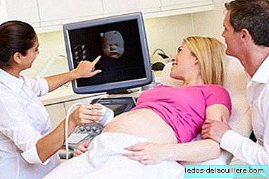 Avez-vous eu une échographie 4D pendant la grossesse? La question de la semaine