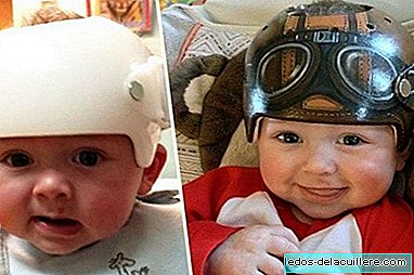 A Californian artist decorates the baby's corrective helmets with an incredible result