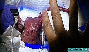 A baby born with 270 grams has managed to get ahead