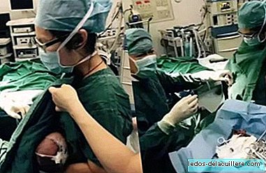 A nurse breastfeeds a baby to calm the pain of the intervention