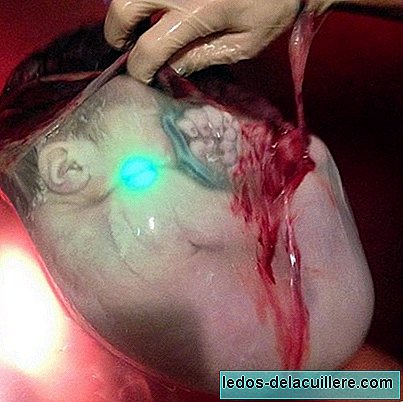 An amazing photo shows how babies are in the womb at birth with the bag intact