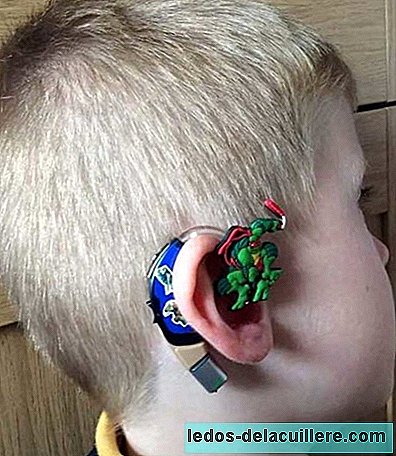 A mother personalizes hearing aids so that her deaf child is proud to wear them