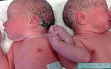 Tweelingen die elkaar de hand gaven bij de geboorte, brengen een heel ziekenhuis in vervoering