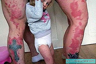 Some parents tattoo their daughter's birthmarks, a nice or absurd gesture?