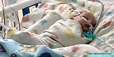 Mereka menggunakan lem cepat untuk mengoperasikan bayi berusia tiga minggu dari aneurisma