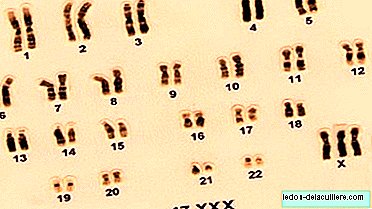 47 ، XXX التثلث الوراثي الأنثوي عند الإناث
