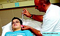 الوخز بالإبر في مستشفى الأطفال سانت جوان دي ديو