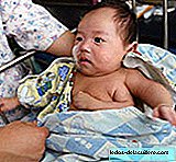 Aumento alarmante de bebês nascidos com malformações na China