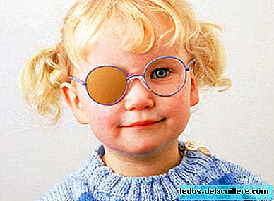 Amblyopia or "lazy eye" in children