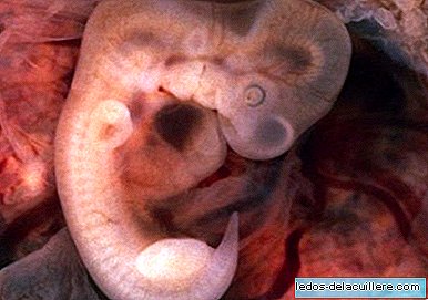 Anesthésie pour le fœtus lors d'un avortement