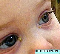 赤ちゃんの目への注意