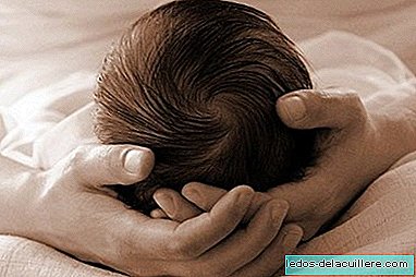 Kūdikių, sergančių plagiocefalija (plokščia galva), atvejų padaugėja