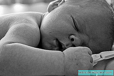 Bebe s krpenim rukama: porodna brahijalna paraliza