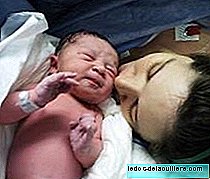 How to promote healing after a cesarean delivery