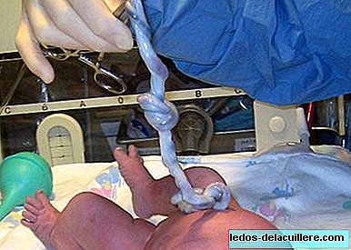 Nästan hälften av föräldrarna har bevarat stamcellerna i barnets navelsträng vid födseln