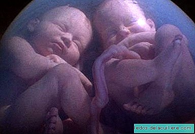 Редки случаи на близнаци