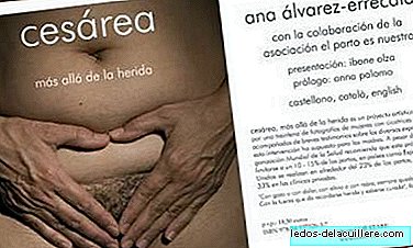 "Cesarean, beyond the wound", book and exhibition