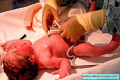 Complications due to umbilical cord infection