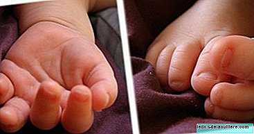 Avez-vous compté tous vos doigts à la naissance?