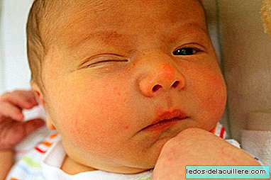Newborn care: how to clean the baby's eyes