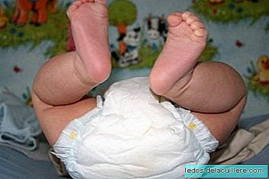 Newborn care: changing the diaper