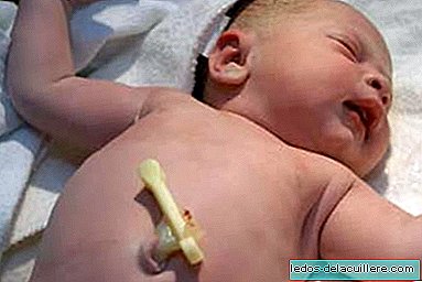 رعاية الأطفال حديثي الولادة: الحبل السري
