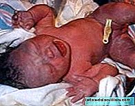 Mengesan penyakit metabolik yang jarang berlaku pada bayi baru lahir