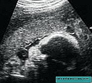 Dnevnik moje nosečnosti: fant ali punca?