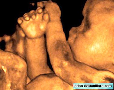 4D ultrasound, what to consider before hiring it?