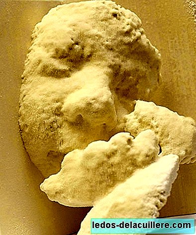 Reliëf echografie: bronzen sculptuur van de foetus