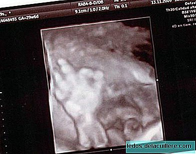 Das Baby, das im Ultraschall "ok" sagte