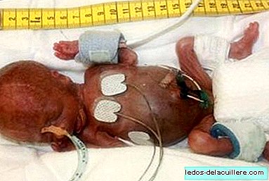 The male baby born with less weight has managed to survive