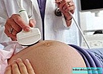 Durch systemischen Lupus erythematodes kann die schwangere Frau sterben