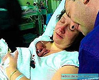 The miracle of a 567 gram baby who survived thanks to his mother's hug
