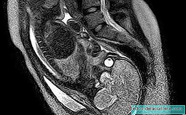 הלידה שנראתה לראשונה בזכות בדיקת MRI