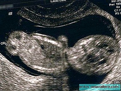 الموجات فوق الصوتية في وقت مبكر من الحمل