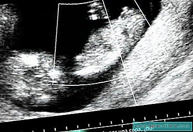 "אפס אלכוהול בהריון", אתר חדש וקמפיין בריאות