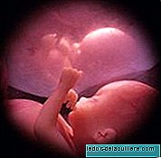 In the womb: twins, triplets and quadruplets