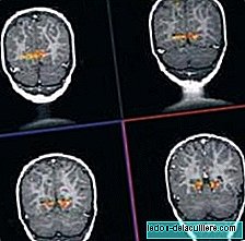 În Statele Unite studiază dezvoltarea creierului copiilor de către RMN