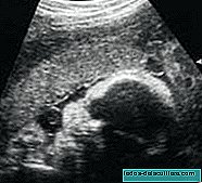 In which cases a fetal echocardiogram is performed