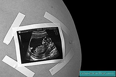 Je suis enceinte: qu'est-ce qui pourrait blesser mon bébé?