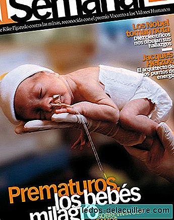 Verhalen van premature baby's op de ICU van neonaten